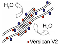 Vitreous Affected